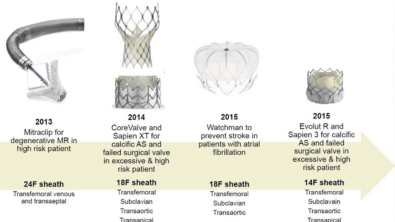 Catheter-Based Therapies for Structural Heart Disease