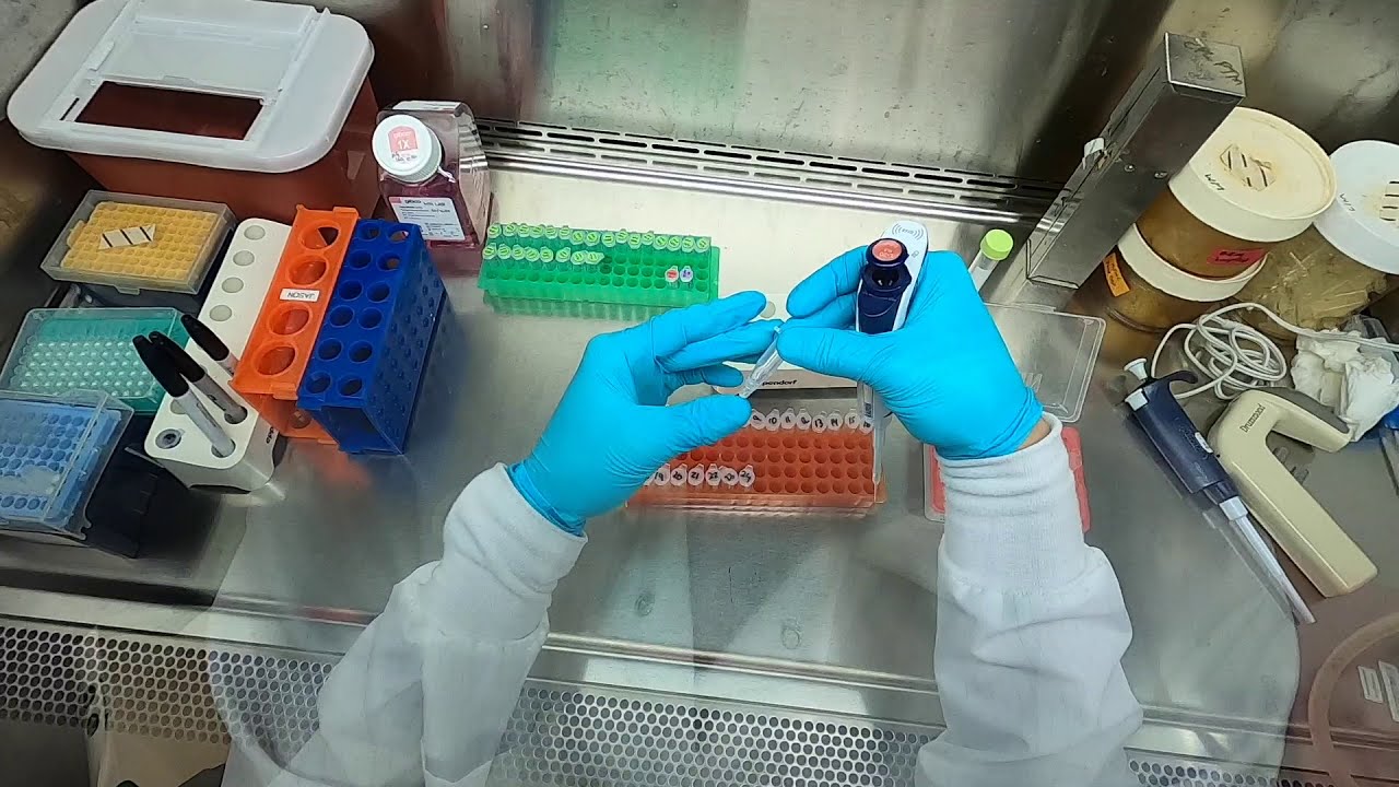 POV: How To Do a Transfection