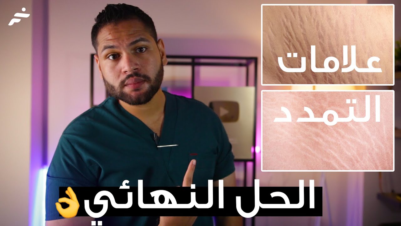 علاج علامات التمدد | علاج علمات التمدد الحمراء والبيضاء في الجسم | تشققات الجلد