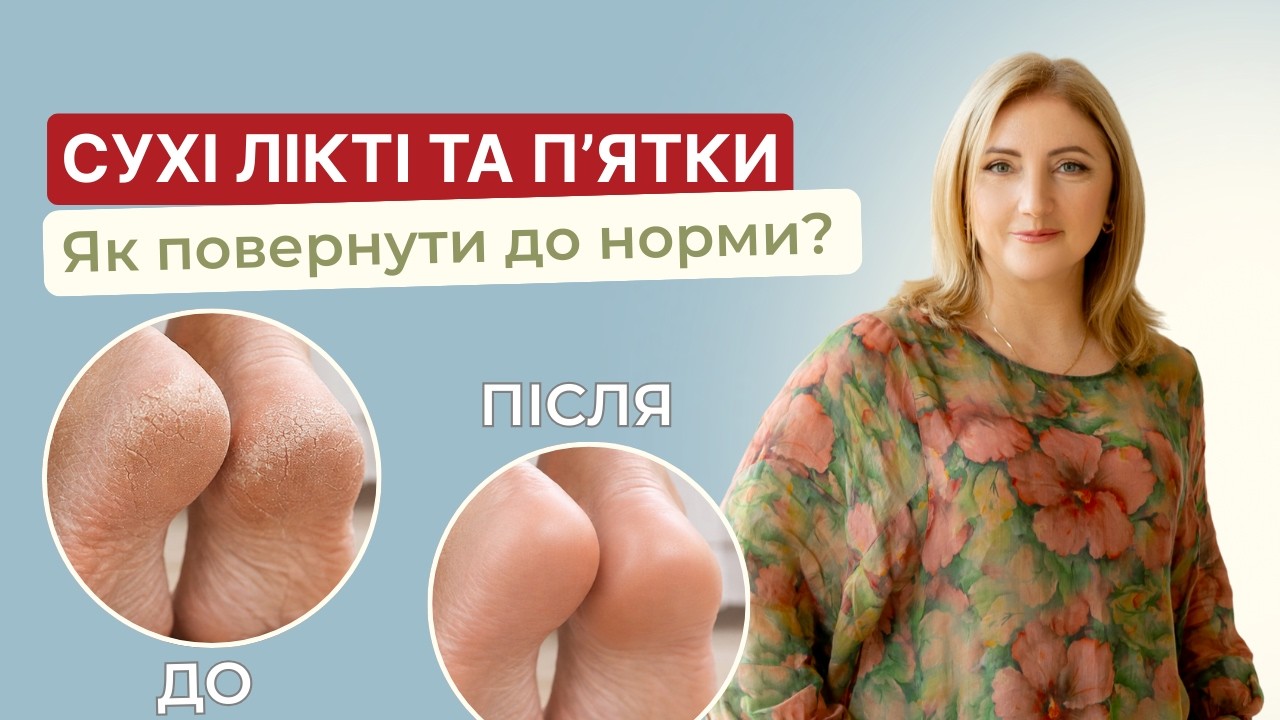 Як прибрати сухість ліктів, п’ят і колін?