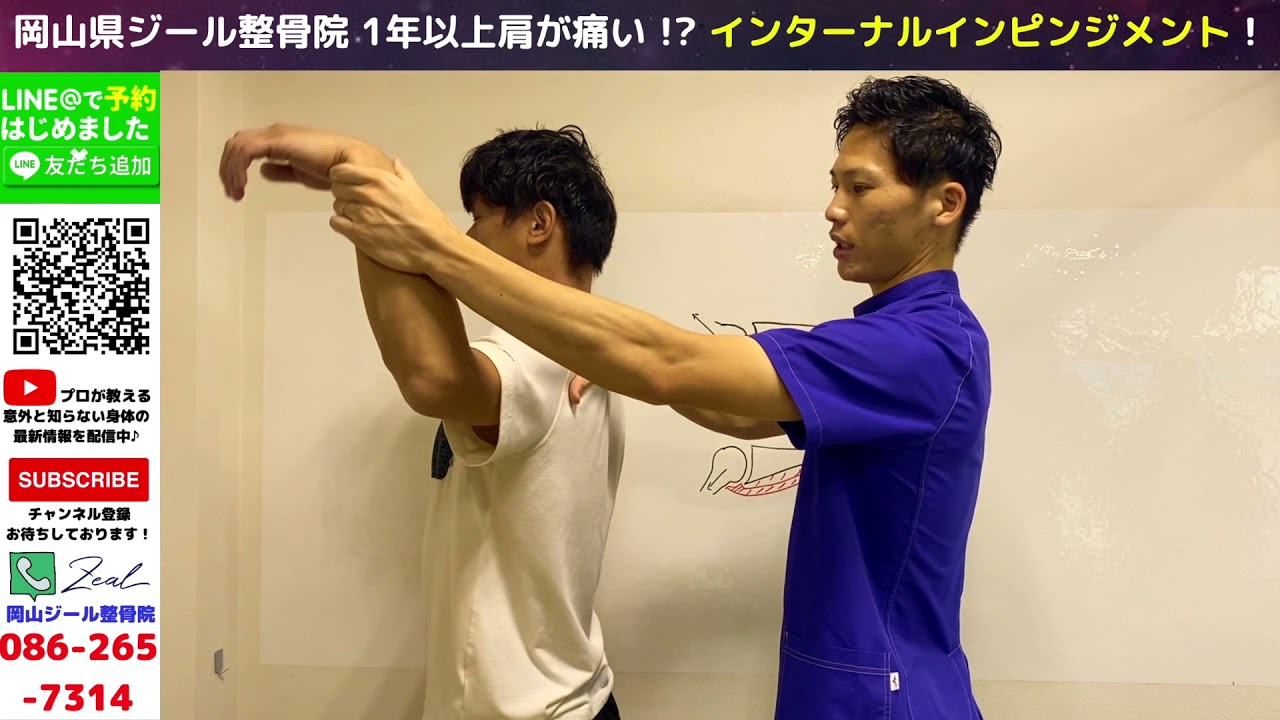 投球前半での痛み！インターナルインピンジメントとは？？