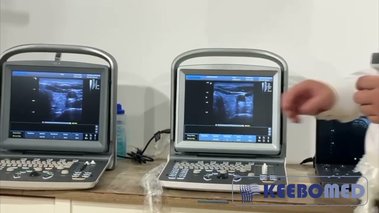 Chison ECO-6 Ultrasound