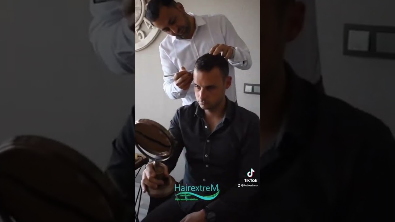 #haartransplantation