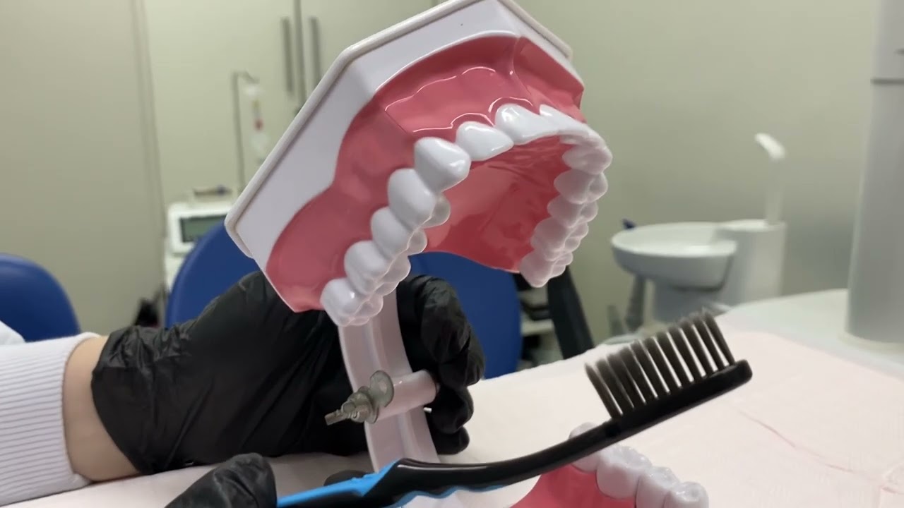 Técnica de escovação: TÉCNICA DE STILLMAN TÉCNICA DE STILLMAN MODIFICADA