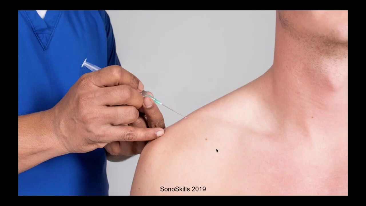 MSK Ultrasound Guided Injections
