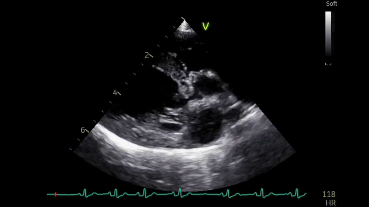 Mitral Valve , Pocket size VS Stationary high end system echo images、dog（2kg)犬の僧帽弁のポケットエコー