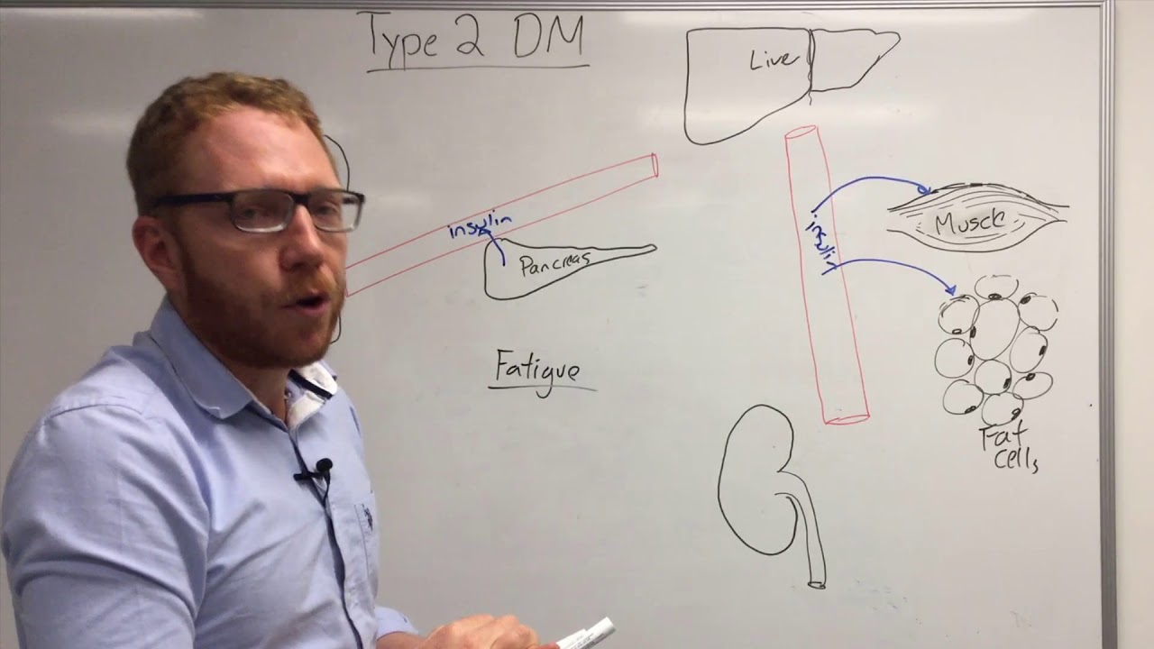 Type 2 Diabetes: Pathophysiology