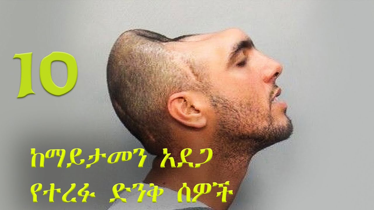 10 ከማይታመን አደጋ የተረፉ ድንቅ ሰዎች | Habesha | Ethiopia