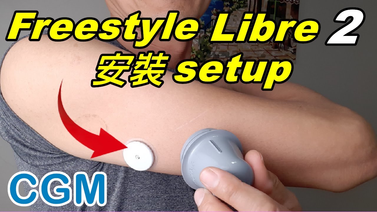 連續血糖監測器安裝，亞培輔理善瞬感連線 Freestyle Librelink 2 安裝與APP下載設定 #freestylelibre
