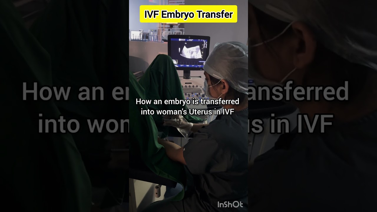 IVF Embryo Transfer by Dr Rakshita Malik #ivf #doctor #mbbs #ivfdoctor #ivfspecialist #ivfprocess