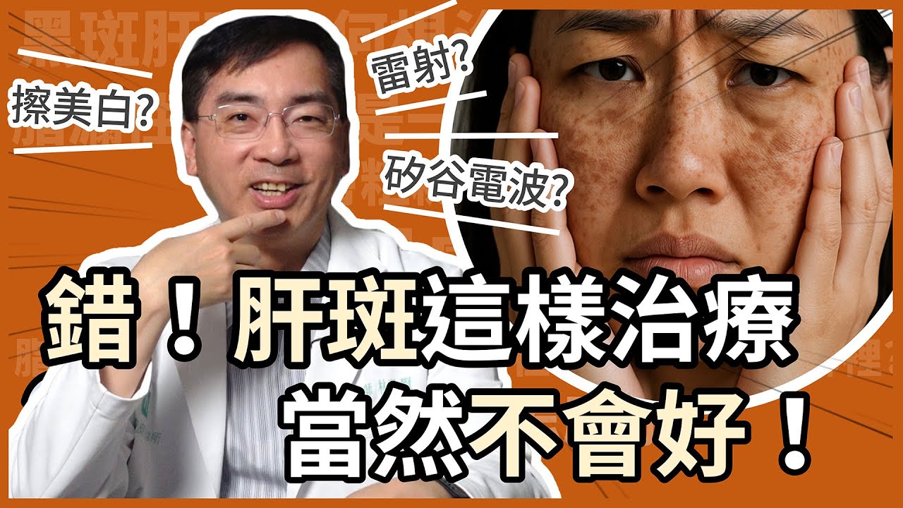 治療肝斑的四大迷思，你錯了幾個？有根治的方法嗎？