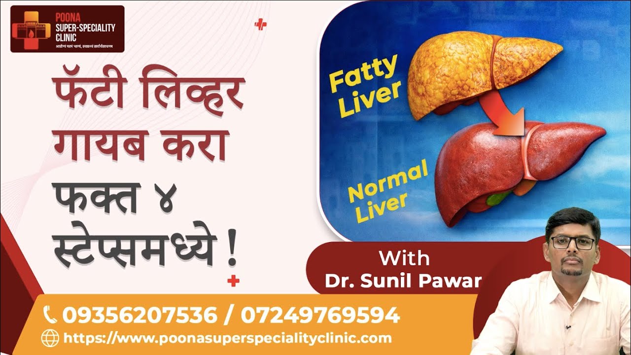 फॅटी लिव्हर गायब करा फक्त ४  स्टेप्समध्ये! | Dr. Sunil Pawar | #fattyliver #fattyliversymptoms