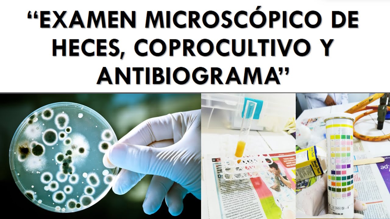 Entendiendo el Examen de Heces: Coprocultivo y Antibiograma