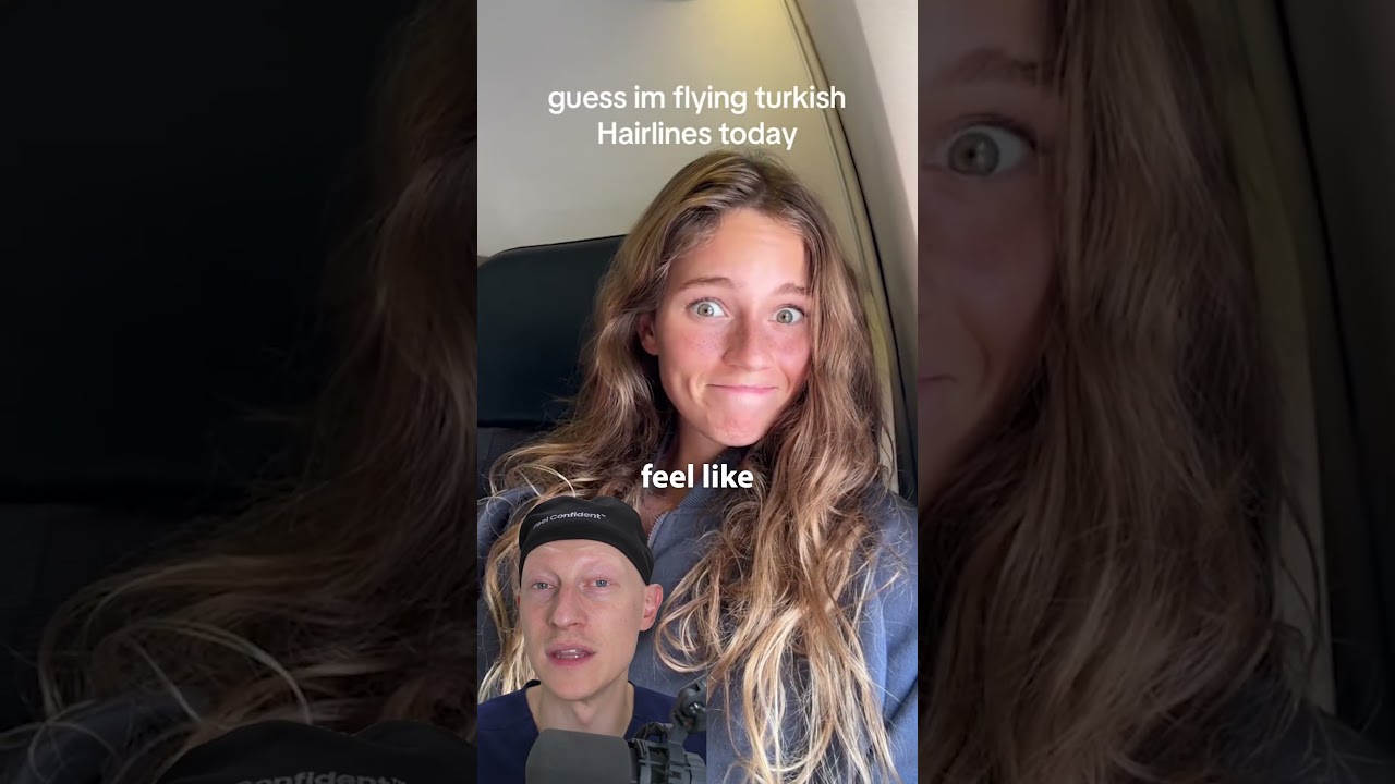 They ALL Got Hair Transplants In Turkey!