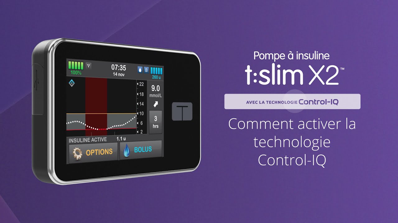 Comment activer la technologie Control-IQ