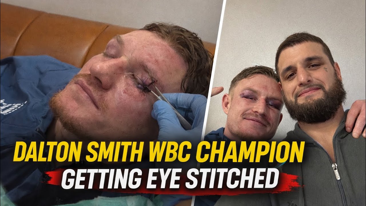 Далтон Смит, чемпион мира по версии WBC, перевязывает глаза.