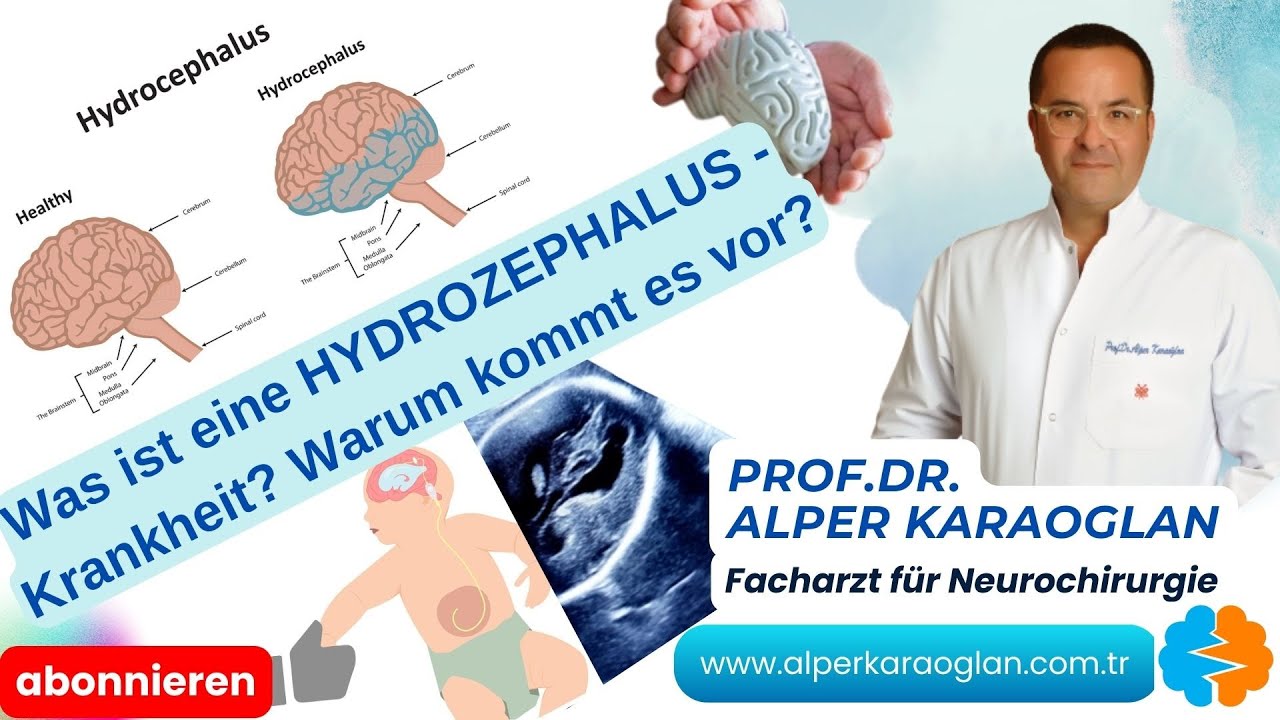 Was ist eine HYDROZEPHALUS-Krankheit? Warum kommt es vor? | Prof.Dr. Alper KARAOGLAN