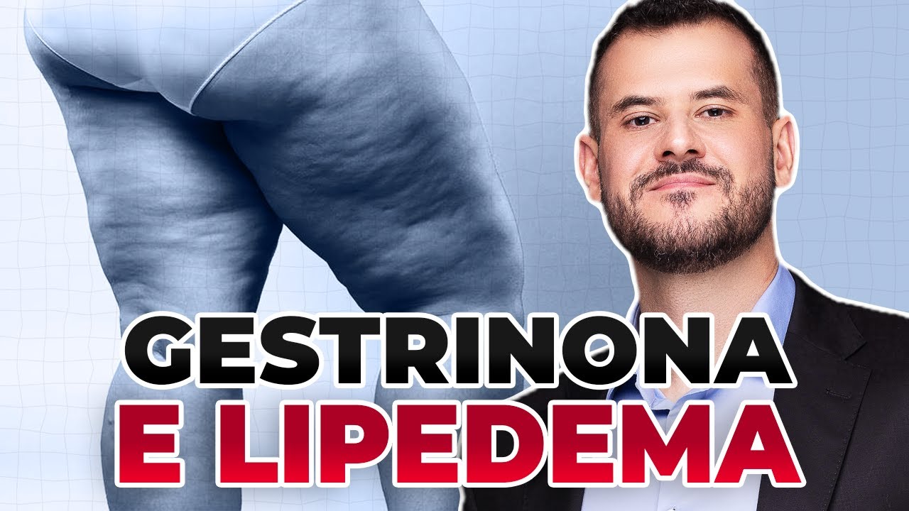 GESTRINONA para TRATAMENTO DO LIPEDEMA