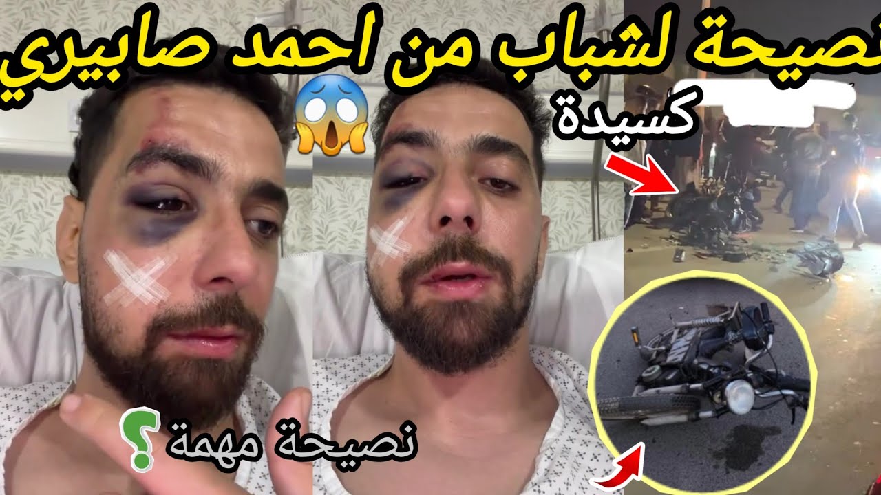 صابيري يحكي كيف وقعت الحادثة 😱 و نصيحة لشباب المغربي من المستشفى ahmed sabiri 
