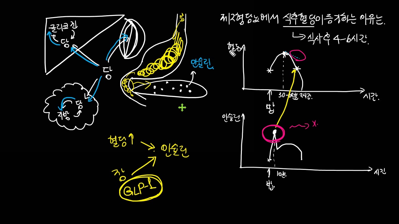 제2형 당뇨, 식후혈당이 증가하는 이유