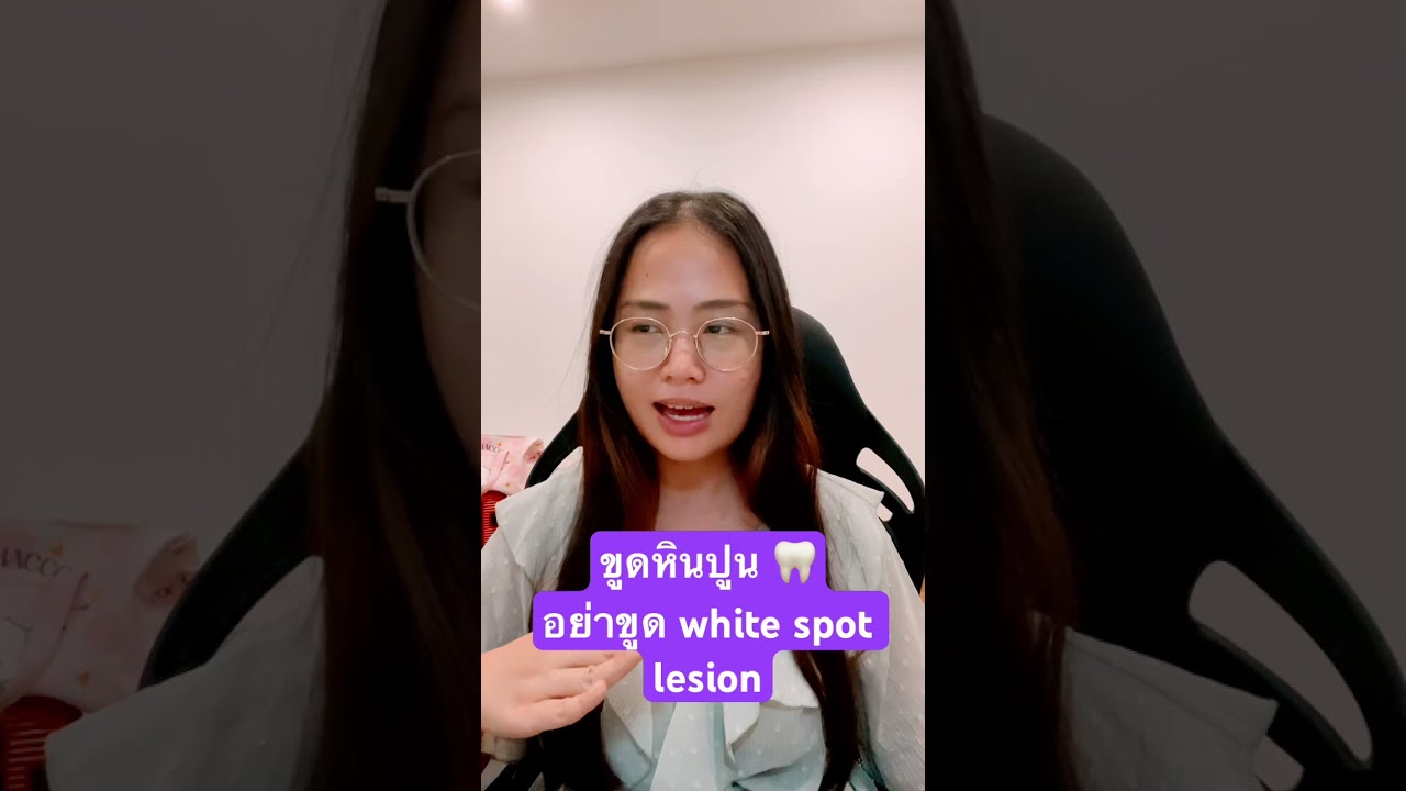 ขูดหินปูน…อย่าขูด white spot lesion 