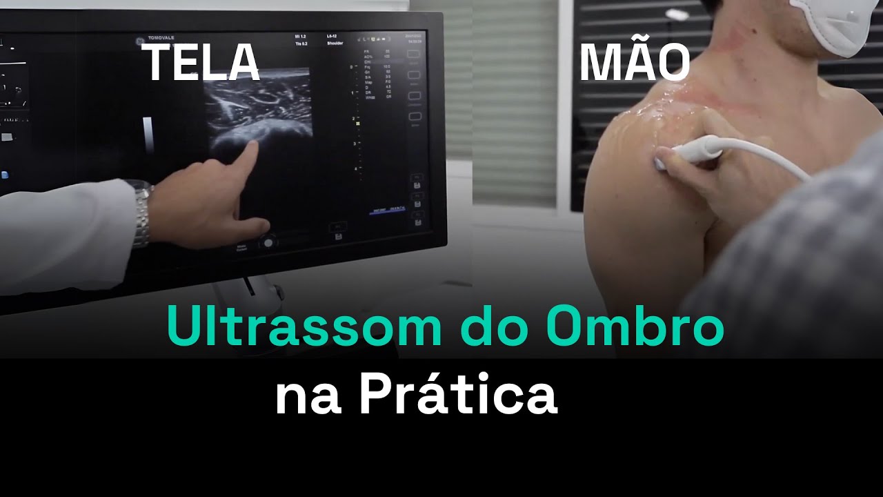 Primeira vez no Ultrassom do Ombro (Na Prática)