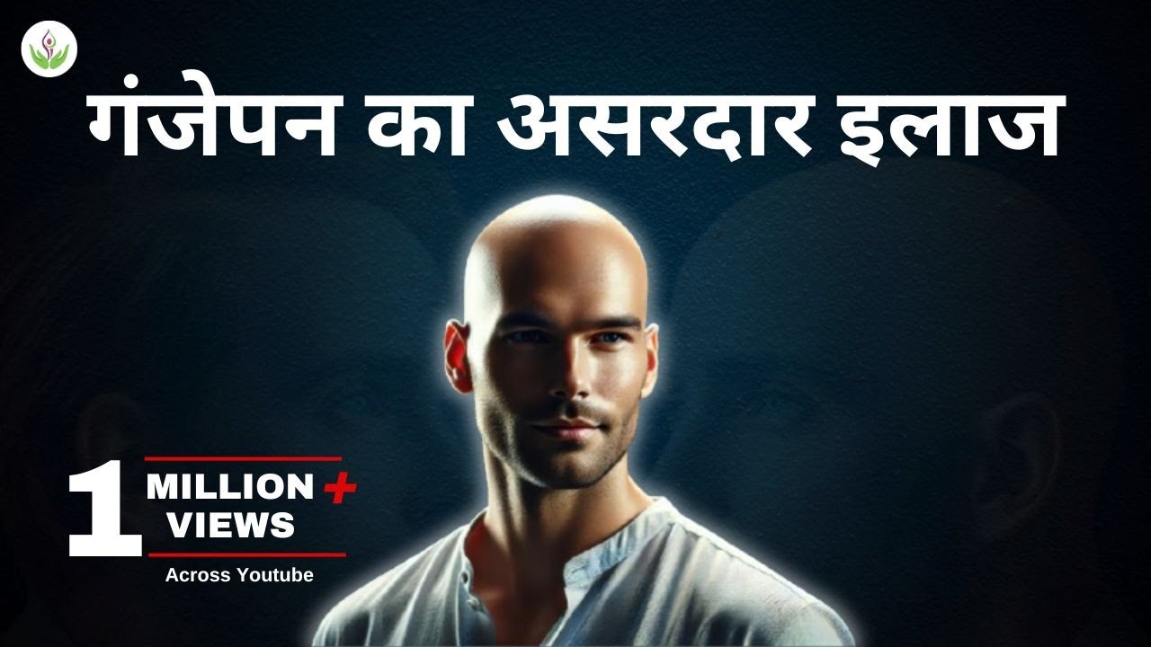Alopecia Areata Treatment 2025 | गंजेपन का असरदार इलाज | Get Your Hair Back Today! 🚀