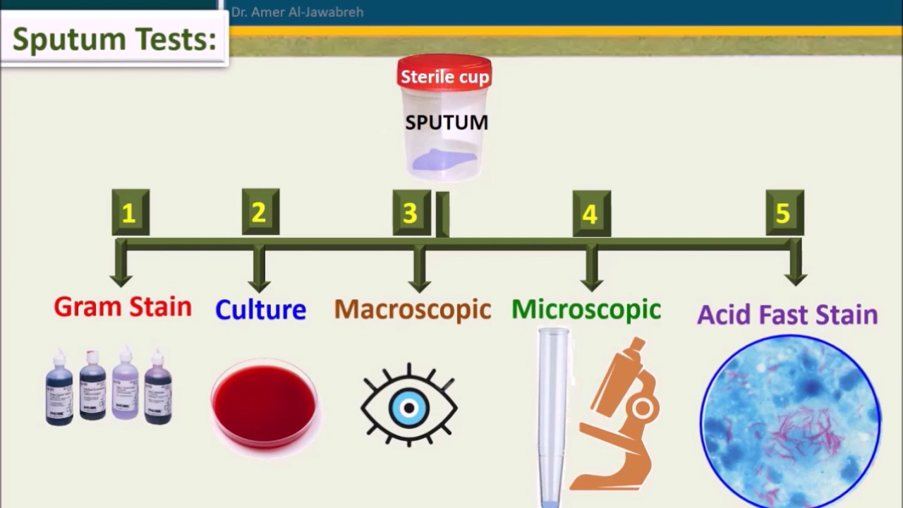 Sputum culture-When to reject sample?