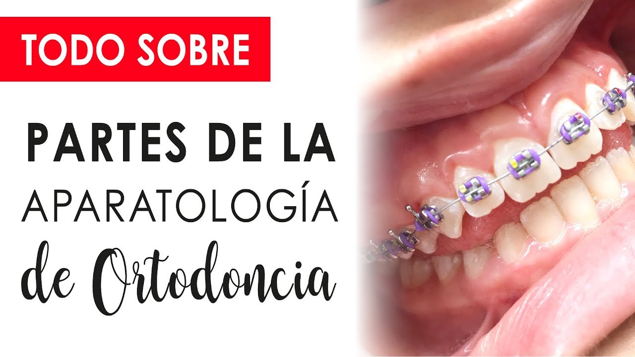BRACKETS Y MÁS APARATOS: BANDAS, TUBOS, PRESCRIPCIÓN?? 😱