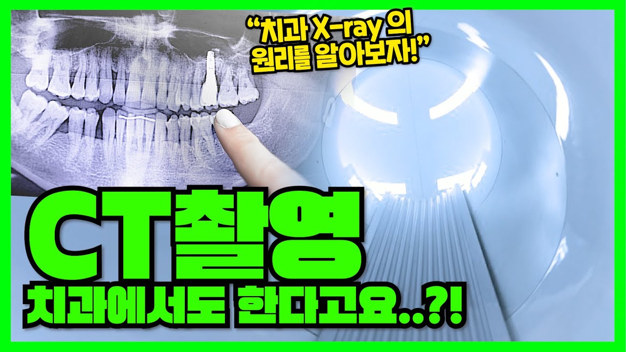 치과에서 찍는 X-ray, CT 촬영🎥은 어떤 비밀이...?! - 올쏘의 아싸