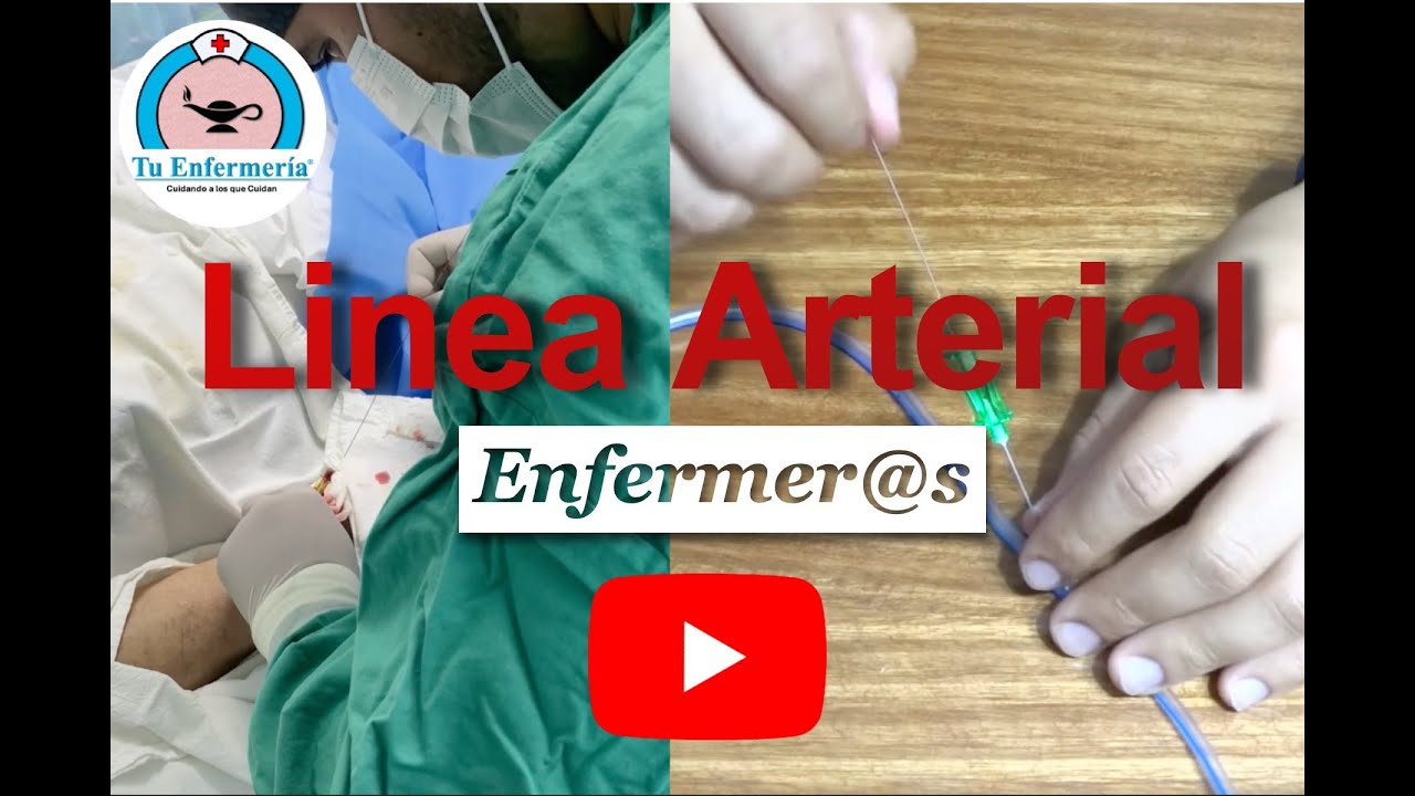 Linea Arterial para Enfermeras y Enfermeros
