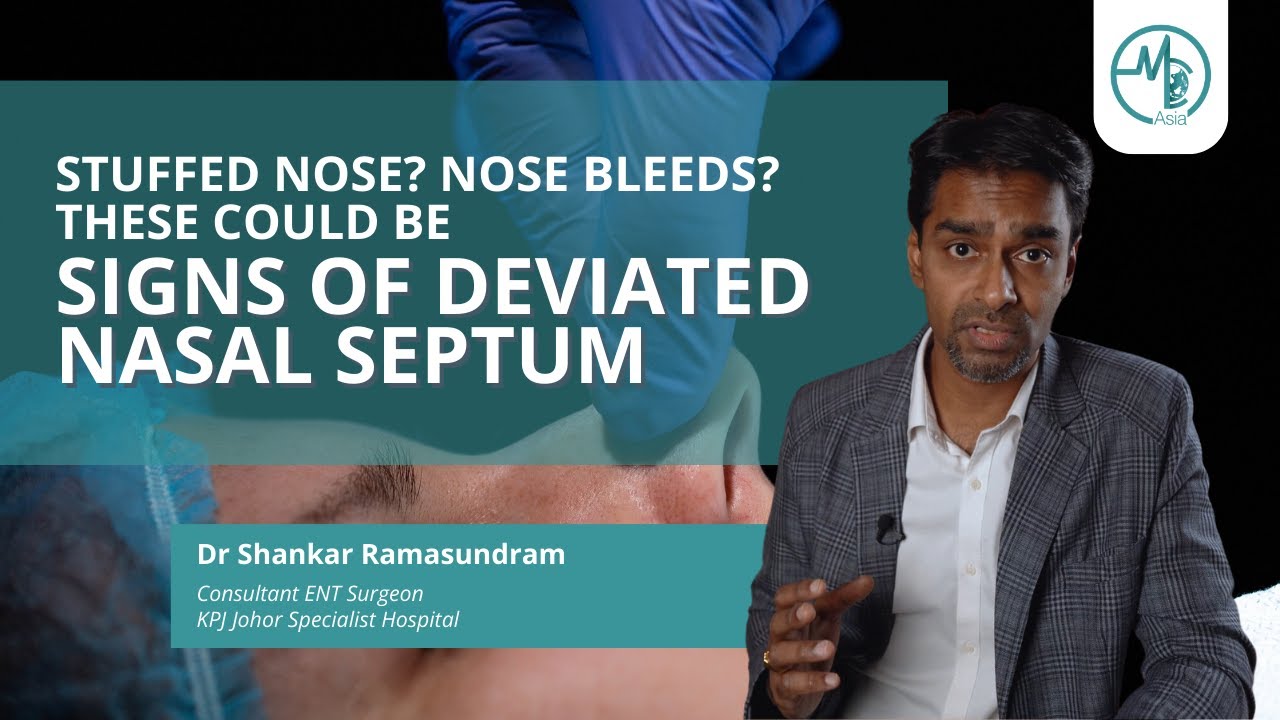 How Serious Is Deviated Nasal Septum | Dr Shankar (ENT Surgeon)