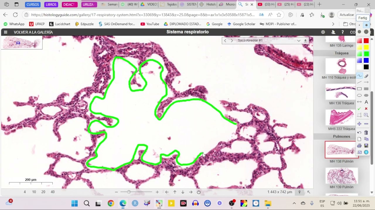 HISTOLOGIA DE PULMON