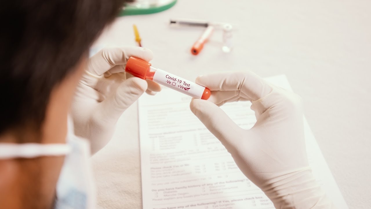 New COVID-19 test will determine how severe the virus will be for each individual