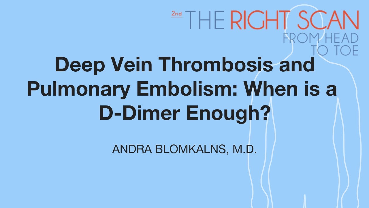 Deep Vein Thrombosis and Pulmonary Embolism: When is a D-Dimer Enough?