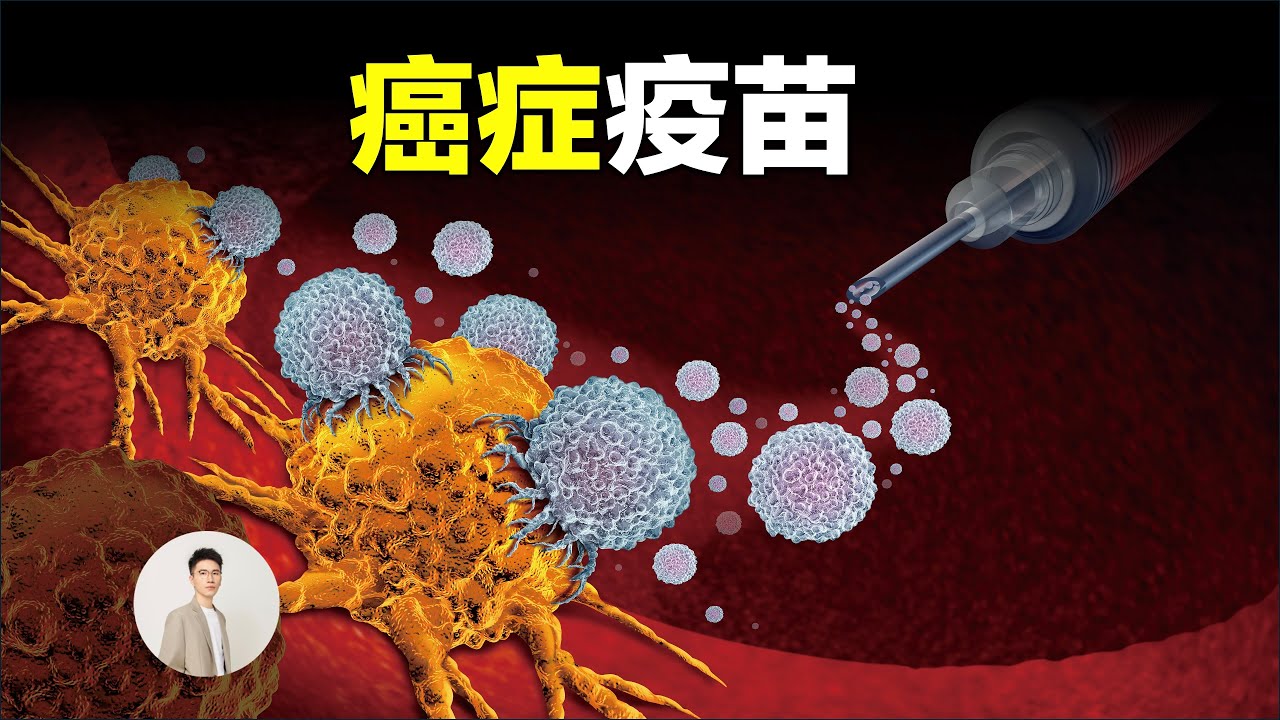 2025年諾獎得主認為人類20年內解決癌症，打一針就能解決所有癌症的疫苗為什麼這麼難設計，把癌細胞變成豬肉是什麼神操作？