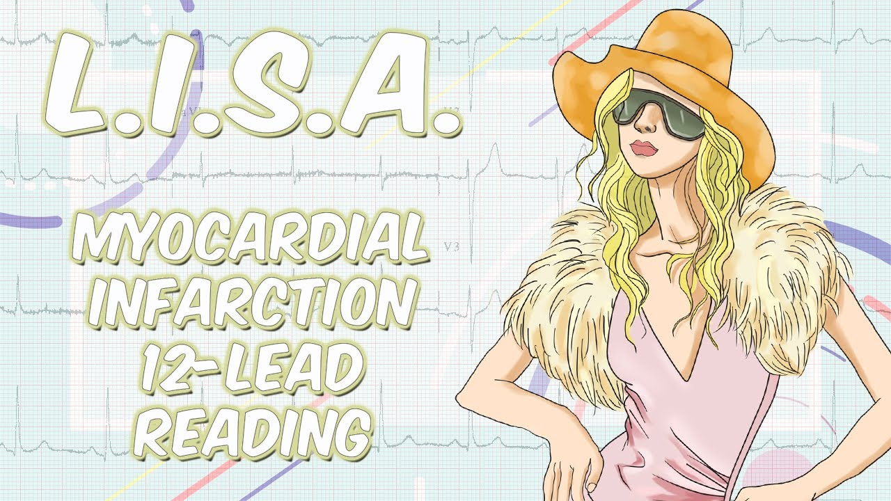 (L.I.S.A.)12 Lead STEMI Recognition Acronym | Something In About 5 Minutes | Medic Materials