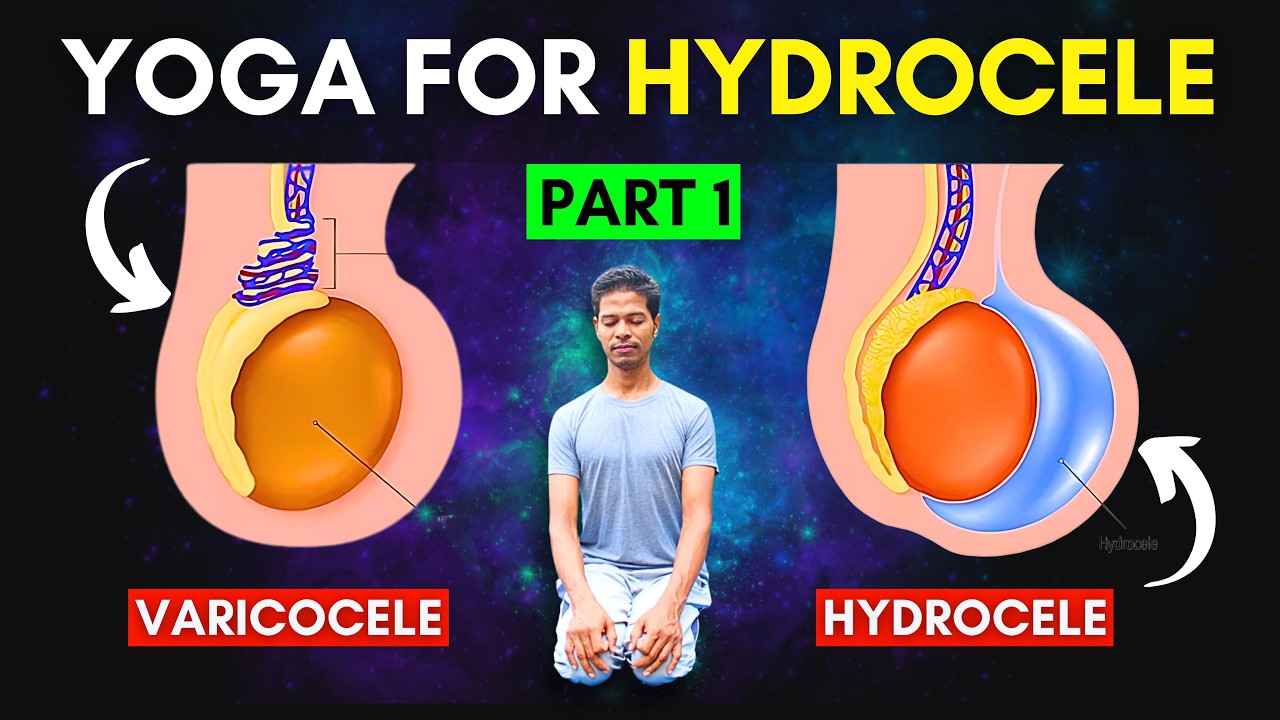 Treat Hydrocele & Varicocele at Home Part 1 | Yoga Exercises for Hydrocele & Varicocele #hydrocele