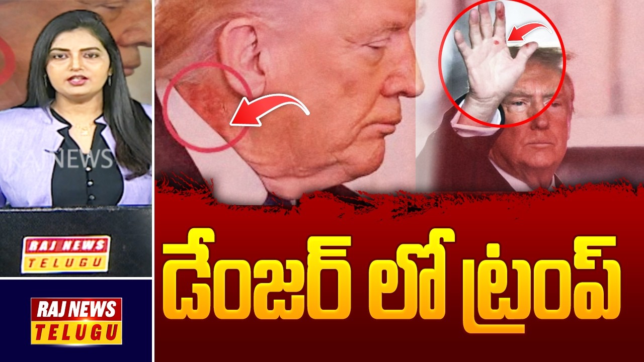 DEBATE : డేంజర్ లో ట్రంప్ - Debate On Trump Neck Rash | Raj News Telugu