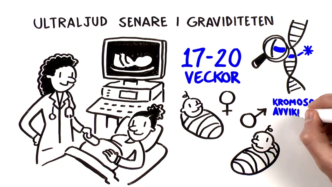 Ultraljud under graviditeten