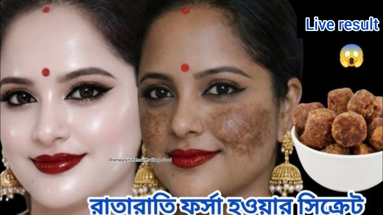 এক রাতে কালচে দাগ  কালো রং থেকে মুক্ত পাবেন😱 মুখ হিরে মতো চকচকে করবে  । ঘরের মানুষ ও সবাই হবে অবাক