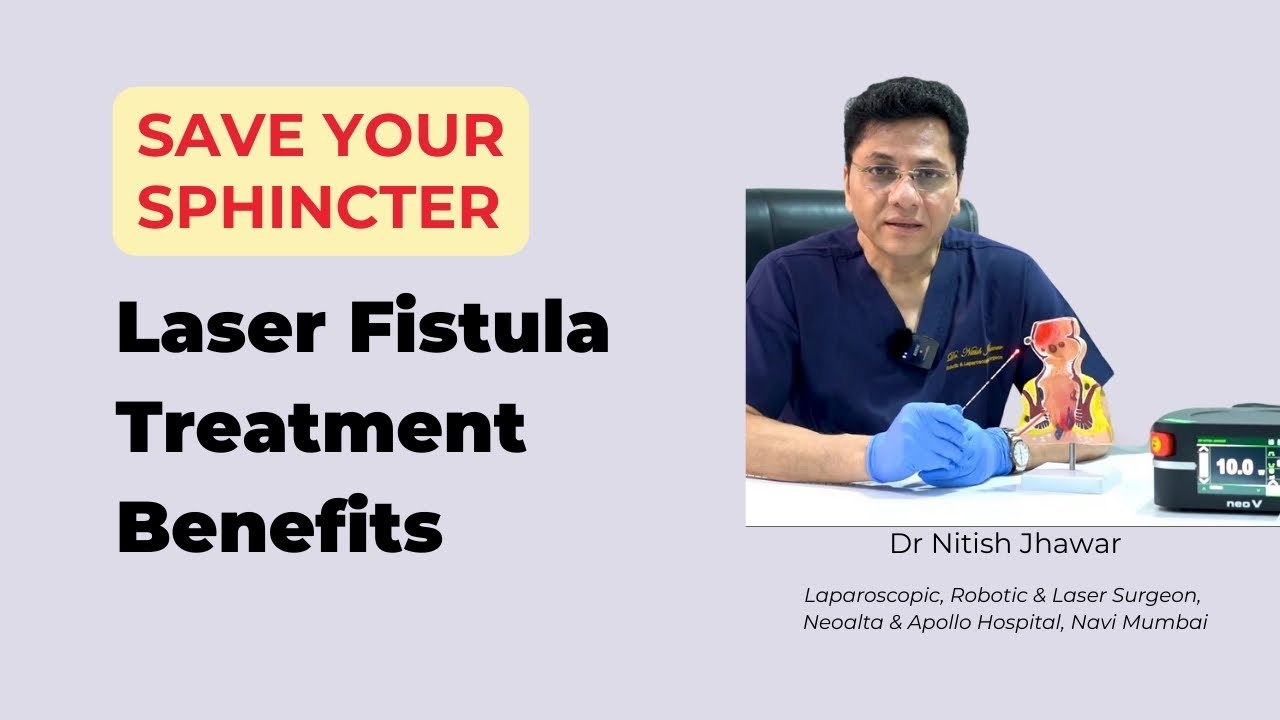 फिस्टुला (भगन्दर) के लिए लेजर उपचार | Benefits of Laser Treatment for Fistula in Hindi