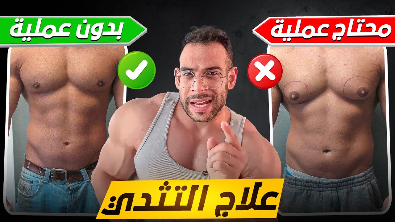أنواع التثدي و الحل بدون عملية