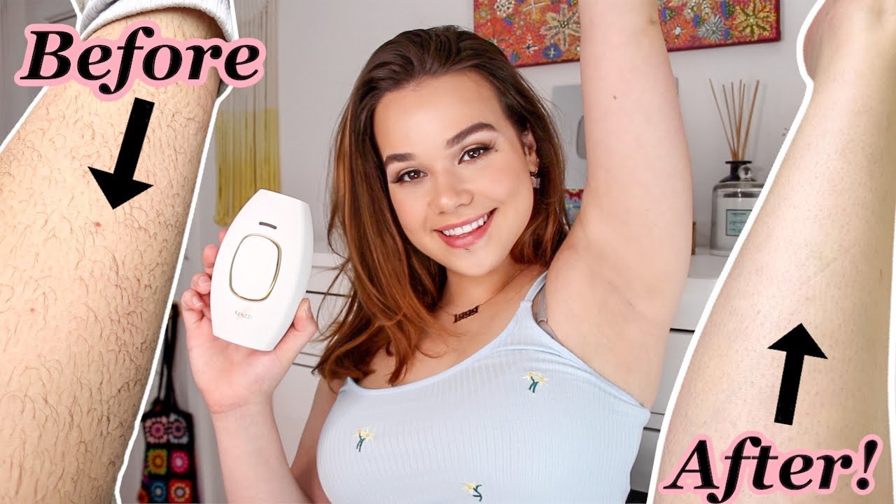I TRIED AT HOME LASER HAIR REMOVAL!