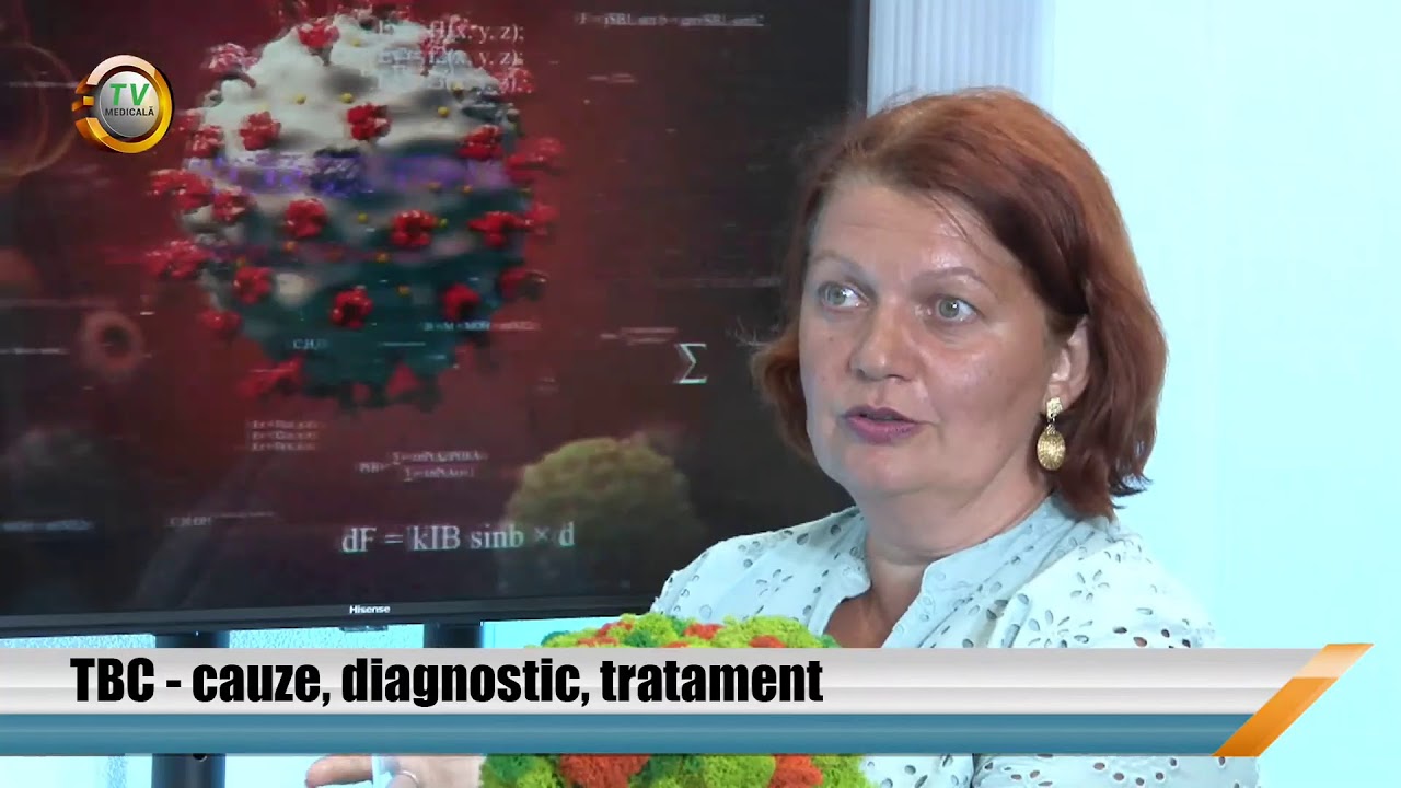 TBC - cauze, diagnostic, tratament