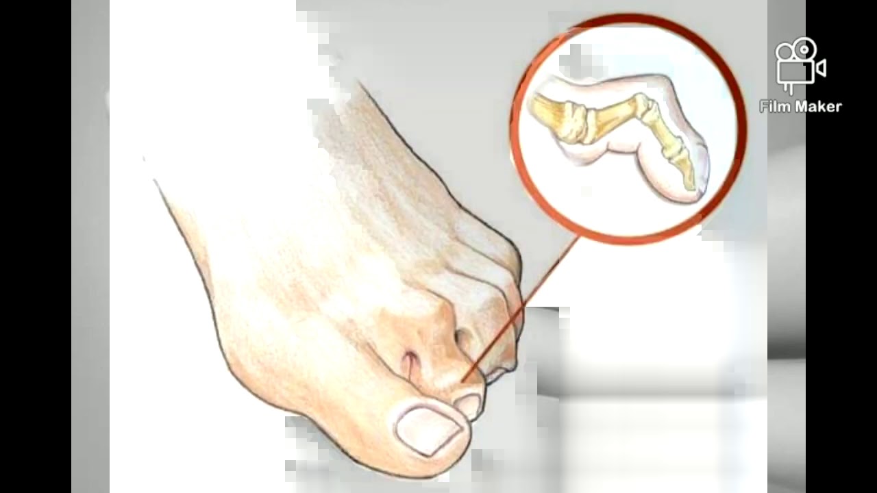 Pedios Foot Solutions