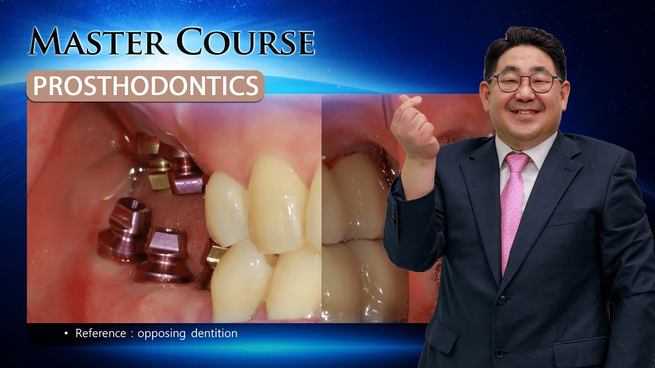 [Master Course - PROSTHODONTICS] Diagnosis & treatment plan for posterior implant