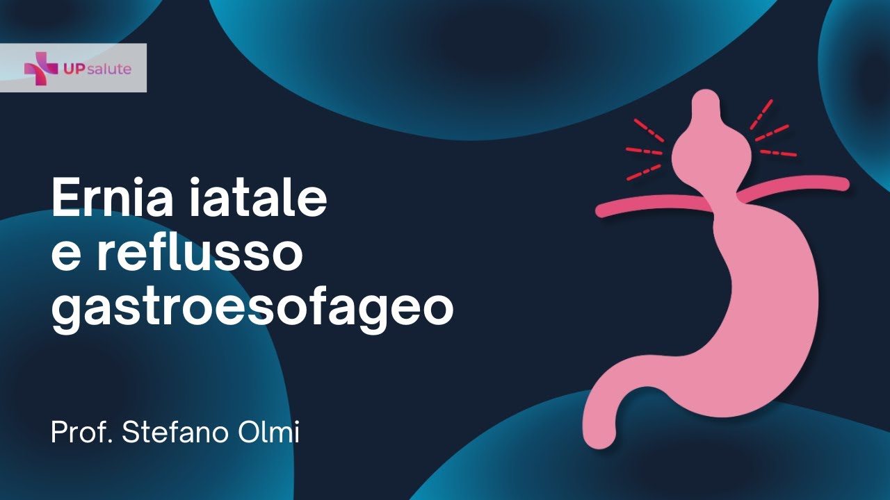 Ernia iatale e reflusso gastroesofageo - Prof. Stefano Olmi - UPsalute Channel