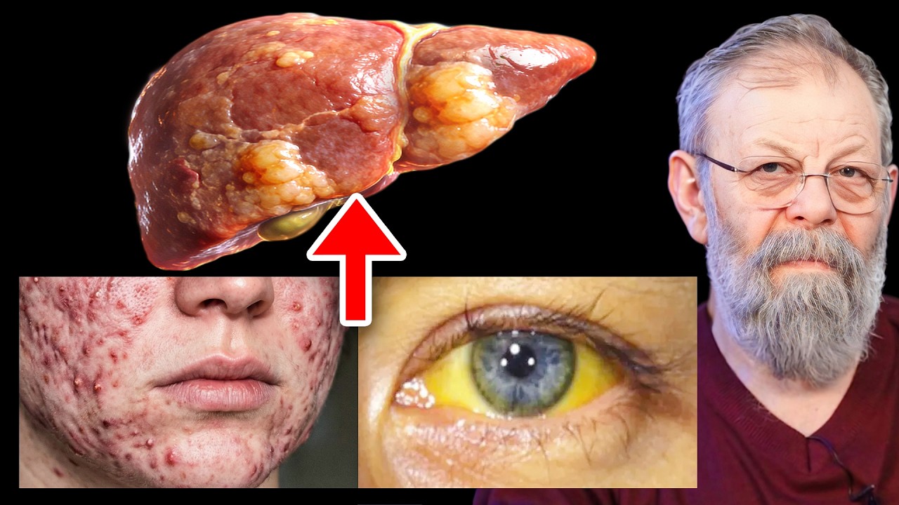 Не доводите до цирроза: одно упражнение помогает очистить печень и улучшить её работу после 60 лет