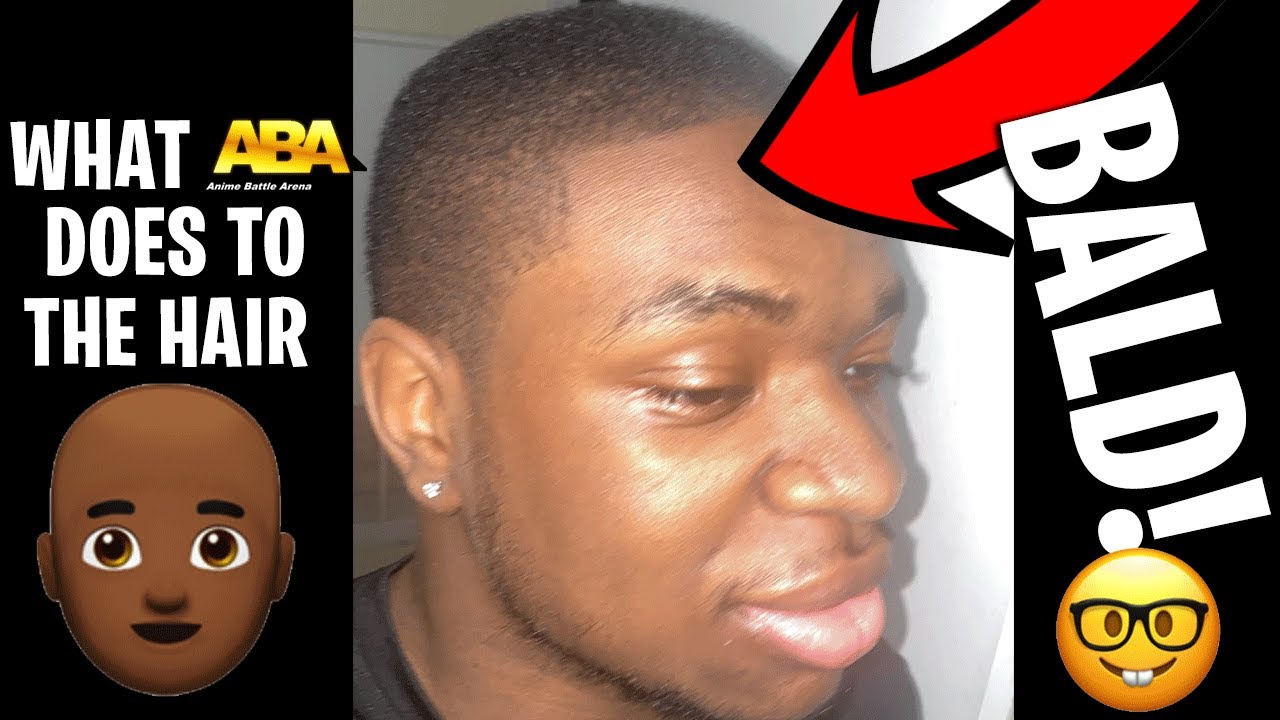 (FACECAM) ABA CAUSED ME TO GO BALD!